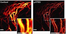 g-STED nanoscopy